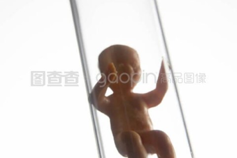 http://xiamen.nbgk120.com/post/198.html|厦门捐卵价格